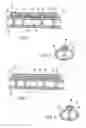 Fig. 02 - Hydrogel bone plate spacer