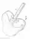Fig. 05 - Osteochondral implant fixation method