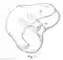 Fig. 09 - Osteochondral implant fixation method