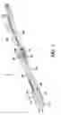 Fig. 02 - Spinal disc replacement surgical instrument and methods for use in spinal disc replacement