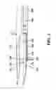 Fig. 04 - Spinal disc replacement surgical instrument and methods for use in spinal disc replacement