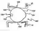 Fig. 01 - Surgical tool and method with an actuation mechanism for controlling reciprocation and locking of an anti-rotation member relative to an engagement member for facilitating positioning of an intervertebral device
