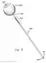 Fig. 04 - Surgical tool and method with an actuation mechanism for controlling reciprocation and locking of an anti-rotation member relative to an engagement member for facilitating positioning of an intervertebral device