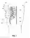 Fig. 02 - Intervertebral prosthetic disc inserter