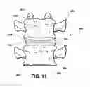 Fig. 09 - Intervertebral prosthetic disc inserter