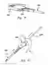 Fig. 08 - Instruments and methods for implanting nucleus replacement material in an intervertebral disc nucleus space