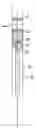Fig. 01 - FILTER/EMBOLI EXTRACTOR FOR USE IN VARIABLE SIZED BLOOD VESSELS