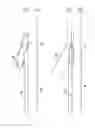 Fig. 03 - FILTER/EMBOLI EXTRACTOR FOR USE IN VARIABLE SIZED BLOOD VESSELS