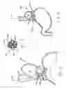 Fig. 03 - Transesophageal gastric reduction method and device for practicing same