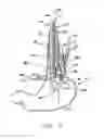 Fig. 05 - Transesophageal gastric reduction method and device for practicing same
