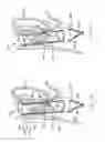 Fig. 07 - Transesophageal gastric reduction method and device for practicing same