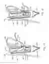 Fig. 09 - Transesophageal gastric reduction method and device for practicing same