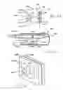 Fig. 14 - Transesophageal gastric reduction method and device for practicing same