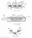 Fig. 15 - Transesophageal gastric reduction method and device for practicing same