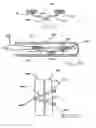 Fig. 17 - Transesophageal gastric reduction method and device for practicing same