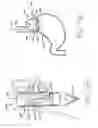 Fig. 19 - Transesophageal gastric reduction method and device for practicing same