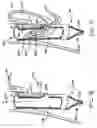 Fig. 06 - Transesophageal gastric reduction method and device for reducing the size of a previously formed gastric reduction pouch