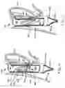 Fig. 07 - Transesophageal gastric reduction method and device for reducing the size of a previously formed gastric reduction pouch