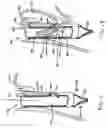 Fig. 08 - Transesophageal gastric reduction method and device for reducing the size of a previously formed gastric reduction pouch