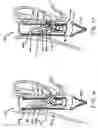 Fig. 10 - Transesophageal gastric reduction method and device for reducing the size of a previously formed gastric reduction pouch