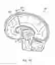 Fig. 09 - MEMBRANE EYELET
