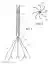 Fig. 02 - Body vessel filter