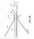 Fig. 06 - Body vessel filter