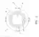 Fig. 03 - Retrievable blood clot filter and method of retrieving