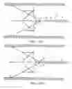 Fig. 18 - Retrievable blood clot filter and method of retrieving