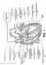Fig. 02 - Method and apparatus for providing ipselateral therapy