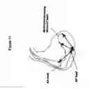 Fig. 13 - QUANTIFYING SYSTOLIC AND DIASTOLIC CARDIAC PERFORMANCE FROM DYNAMIC IMPEDANCE WAVEFORMS