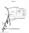 Fig. 04 - Methods and apparatus for treating anaphylaxis using electrical modulation