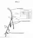 Fig. 04 - Electrical stimulation treatment of hypotension