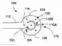 Fig. 01 - Wide-field retinal prosthesis
