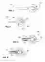 Fig. 04 - Wide-field retinal prosthesis