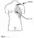 Fig. 04 - Method of determining the sympathetic tone and system for measurement thereof