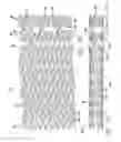 Fig. 05 - Stent pattern for high stent retention