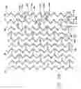 Fig. 10 - Stent pattern for high stent retention