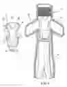 Fig. 03 - Endovascular graft adapter