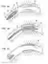 Fig. 02 - Bioerodible endoprostheses and methods of making the same