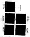 Fig. 07 - MEDICAL DEVICE WITH COATING FOR CAPTURING GENETICALLY-ALTERED CELLS AND METHODS FOR USING SAME