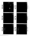 Fig. 08 - MEDICAL DEVICE WITH COATING FOR CAPTURING GENETICALLY-ALTERED CELLS AND METHODS FOR USING SAME