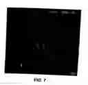 Fig. 10 - MEDICAL DEVICE WITH COATING FOR CAPTURING GENETICALLY-ALTERED CELLS AND METHODS FOR USING SAME
