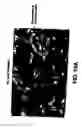 Fig. 13 - MEDICAL DEVICE WITH COATING FOR CAPTURING GENETICALLY-ALTERED CELLS AND METHODS FOR USING SAME