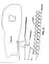 Fig. 16 - MEDICAL DEVICE WITH COATING FOR CAPTURING GENETICALLY-ALTERED CELLS AND METHODS FOR USING SAME