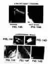 Fig. 19 - MEDICAL DEVICE WITH COATING FOR CAPTURING GENETICALLY-ALTERED CELLS AND METHODS FOR USING SAME