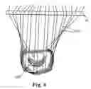 Fig. 08 - Flexible annuloplasty prosthesis