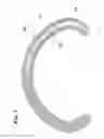 Fig. 05 - PROSTHESIS FOR ANNULOPLASTY COMPRISING A PERFORATED ELEMENT