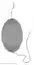Fig. 01 - Radially extended support member for spinal nucleus implants and methods of use