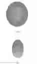 Fig. 03 - Radially extended support member for spinal nucleus implants and methods of use